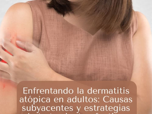 Enfrentando la dermatitis atópica en adultos: Causas subyacentes y estrategias de tratamiento efectivas