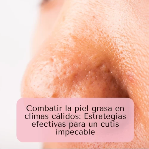 Combatir la piel grasa en climas cálidos: Estrategias efectivas para un cutis impecable